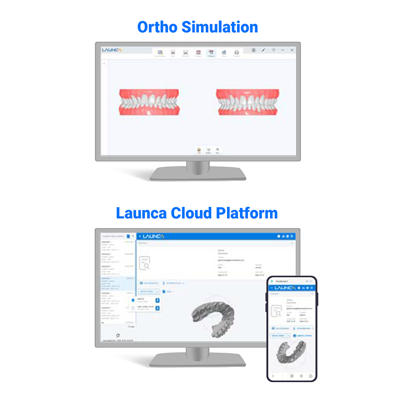 intraoral scanner intraoral scanner